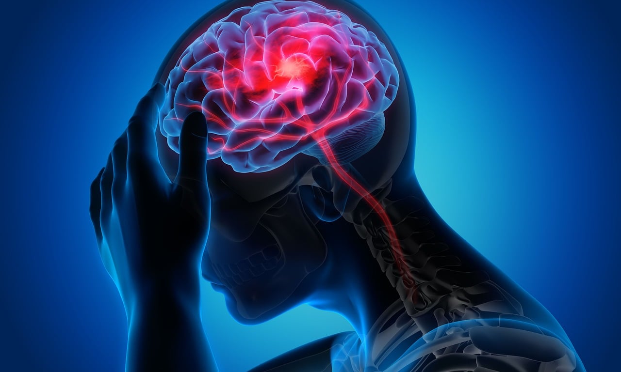 Migraine Relief OTC: Types and Usage